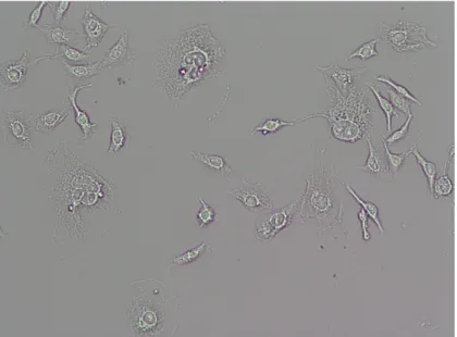Figure 1: MCF-7 human adenocarcinoma cells labeled with CM-DiI, bright field image  taken at 10x magnification