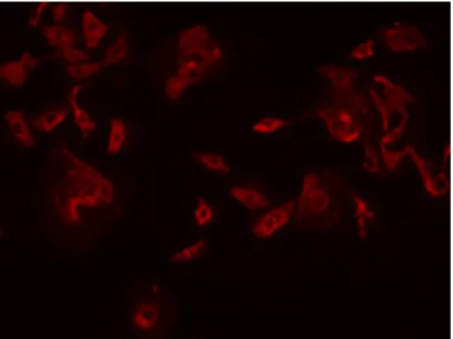 Figure 2: Fluorescing MCF-7 human adenocarcinoma cells labeled with CM-DiI under  10x magnification under the green excitation fluorescence filter at 570 nm 