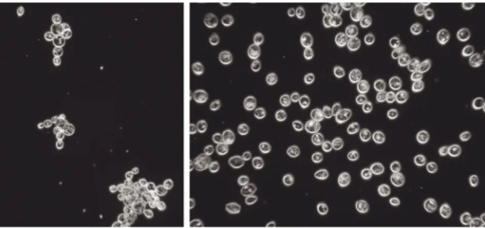 Figure 5.1      Bottom -   (left)  and  top - fermenting  yeasts  (right)  under the microscope (  × 640  magnifi cation)