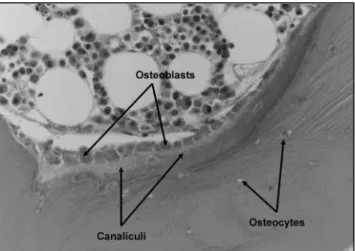 Figure 2. New bone formation through the transformation of collagen of the proteinaceous matrix  mineralizing into canaliculi