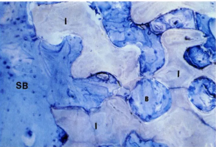 Figure 4 taken 138 months after implantation illustrates total bone ingrowth of Interpore  200 HA block