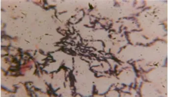 Gambar 7. Bacillus licheniformis dengan perbesaran 1000x 