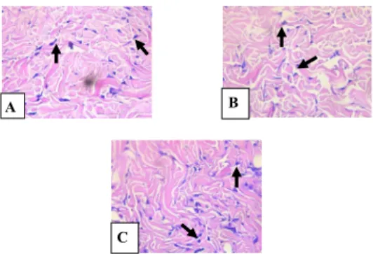 Figure 2. Histopathology of Fibroblast Cells in Incisional Back Wound Healing of Rat on Day 7 th : (A) Placebo  Gel Group, (B) 15% Binjai Leaves Gel Extract Group, (C) 15% Ramania Leaves Gel Extract Group 