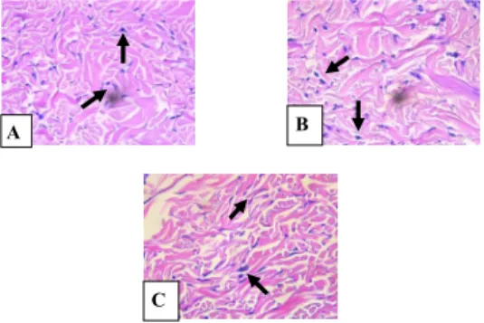 Figure  2  shows  the  histopathology  of  fibroblast  cells  number  in  incisional  back  wound  of  rat given  placebo gel group with a total of 9-12 cells, binjai leaves extract gel at the concentration of 15% group with a  total of 14-18 cells, and la