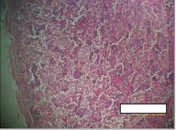 Gambar 4. Limfositofagositosis I 