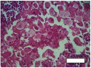 Gambar 6. Limfositofagositosis II 