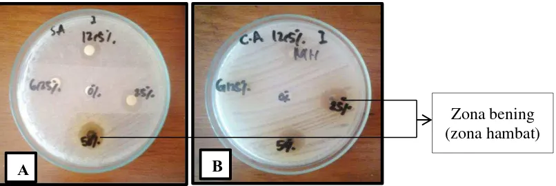 Gambar 12. (A) Percobaan pada Staphylococcus aureus 