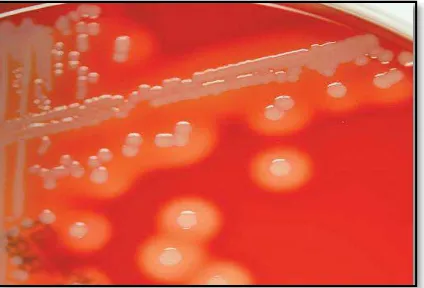 Gambar 2. Staphylococcus aureus pada pewarnaan Gram positif .26  