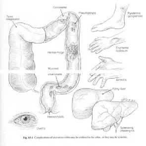 Gambar 2.3. Gambaran klinis