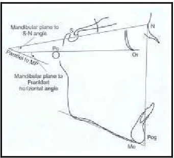Gambar 7.  Sudut rotasi mandibula24 