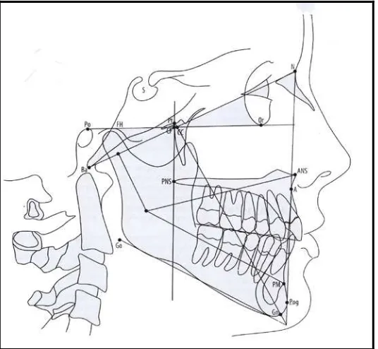 Gambar 4. Bidang atau garis pada sefalometri 22