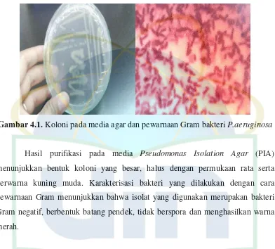 Gambar 4.1. Koloni pada media agar dan pewarnaan Gram bakteri P.aeruginosa 