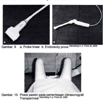 Gambar. Gambar. 89 a. Probe linear b. Endocavity prove