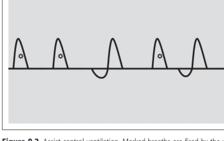 Table 9.7      Complications of endotracheal intubation. 