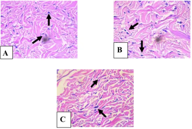 Figure  2  shows  the  histopathology  of  fibroblast  cells  number  in  incisional  back  wound  of  rat  given  placebo gel group with a total of 9-12 cells, binjai leaves extract gel at the concentration of 15% group with a  total of 14-18 cells, and l