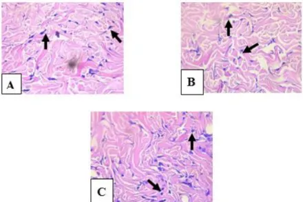 Figure 2.  Histopathology of Fibroblast Cells in Incisional Back Wound Healing of Rat on Day 7 th : (A)  Placebo Gel Group, (B) 15% Binjai Leaves Gel Extract Group, (C) 15% Ramania Leaves Gel Extract 