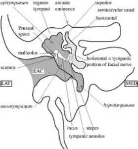 Gambar 2.2. Rongga Prussak atau resesus membran timpani anterior 