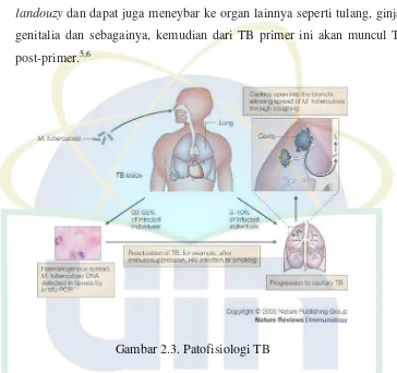 Gambar 2.3. Patofisiologi TB 