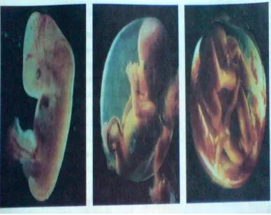 Gambar 6. Tahap perkembangan janin pada rahim manusia 