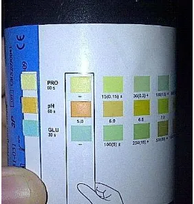 Gambar 2.7 Stik dengan 3 reagen untuk uji dipstick 
