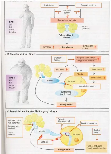 Gambar 2. Tipe-tipe Diabetes Melitus