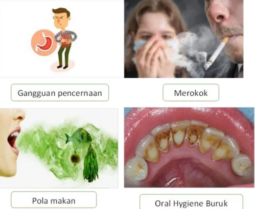 Gambar 3. Penyebab Halitosis 