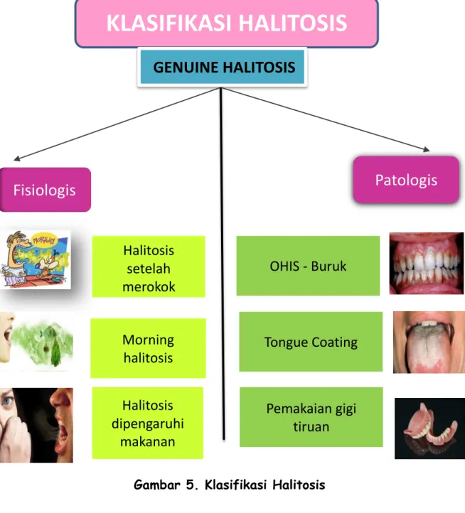 Gambar 5. Klasifikasi Halitosis 