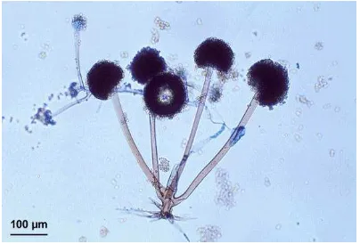 Gambar 1. Morfologi Rhizopus oligosporus Sumber : David Ellis (http://www.mycology.adelaide.edu.au/17/02/2010)  