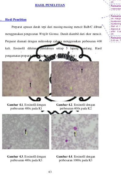 Gambar 4.4. Eosinofil dengan perbesaran 1000x pada K3 