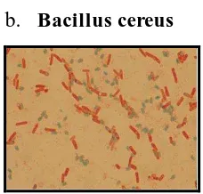 Gambar 8. Bacillus cereus 