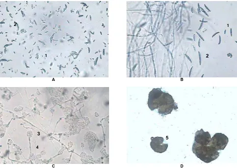 Gambar 1. Penampakan mikroskopis: A. Fusarium sp. 1, B. Fusarium sp. 2, C. Cephalosporium, D