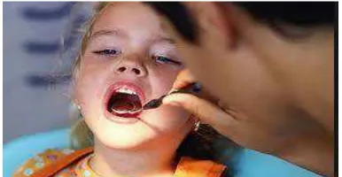 Gambar 2: Pemeriksaan rongga mulut.22 