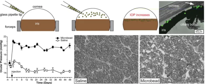 Figure 2.1. Elevation of intraocular pressure by microbead occlusion of aqueous outflow