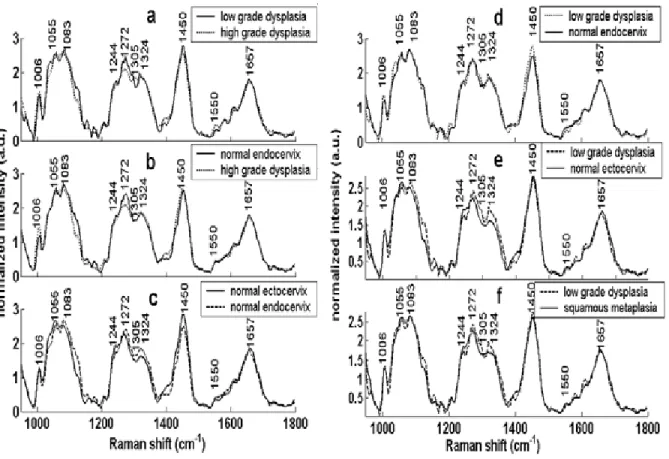 Figure  3.5: Comparisons of Mean Spectra.  
