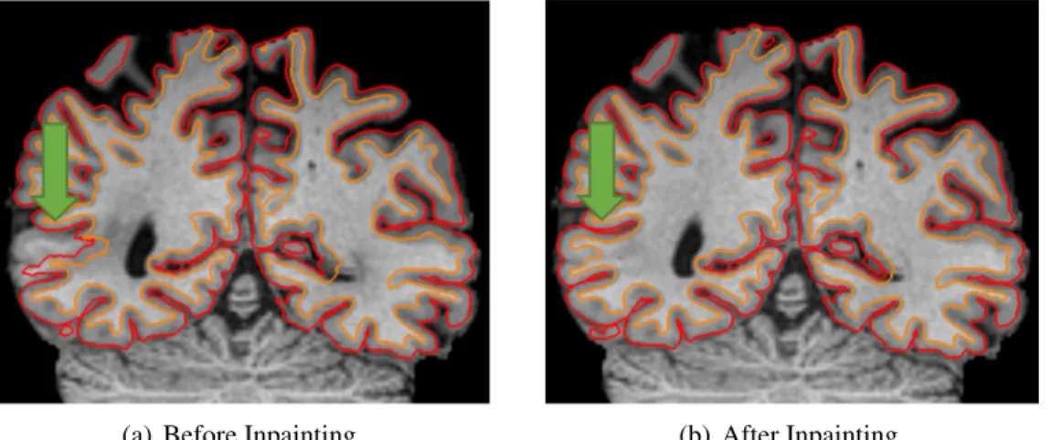 Figure 1.2: An example of morphological analysis before and after inpainting.