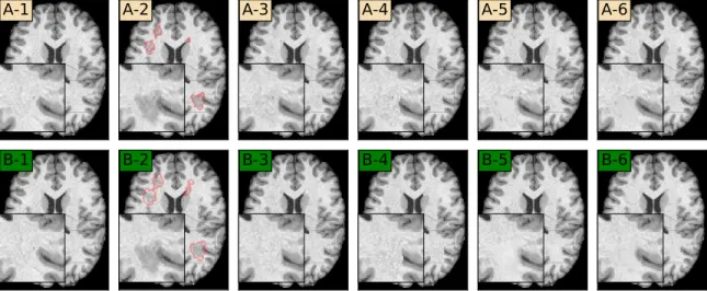 Figure 4.3: Qualitative evaluation (simulated dataset). Group (A) uses “ground truth” le- le-sion mask inputs