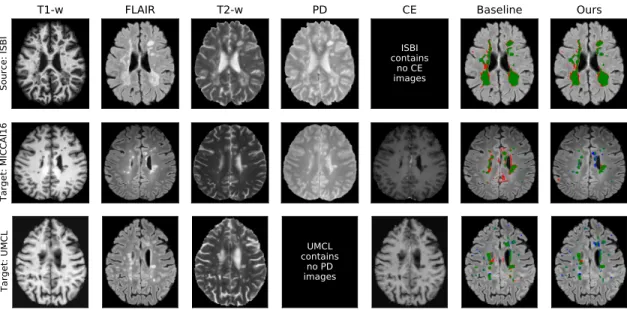 Figure 5.1: Example of domain generalization. From top to bottom: ISBI (source domain for both models), MICCAI16, and UMCL