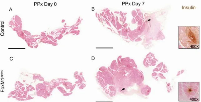 Figure 28.  Regeneration of the splenic lobe was observed within 7 days after  60% PPx in Control and FoxM1 ∆panc mice