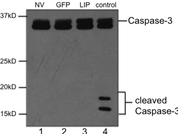Figure 10. LIP expression does not induce caspase-3 activation.  Whole cell  lysates  were  prepared  from  control  NV  (lane  1),  Ad-GFP  MDA-MB-468  cells  (lane 2), Ad-LIP MDA-MB-468 cells (lane 3) infected at a MOI of 10