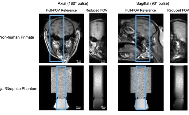 Figure 4.4: Middle axial and sagittal slices of reduced-FOV images compared with full-FOV high-resolution structural scans of in vivo macaque brain (top) and a brain-tissue mimicking phantom (bottom)