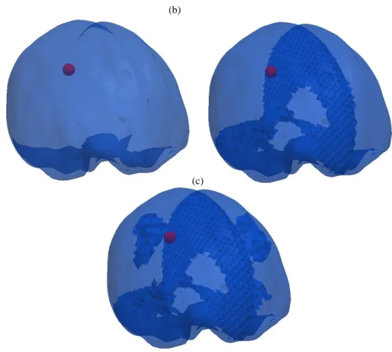 Figure VII. 12: The mesh in Detail (a) shows the brain treated as a homogenous material