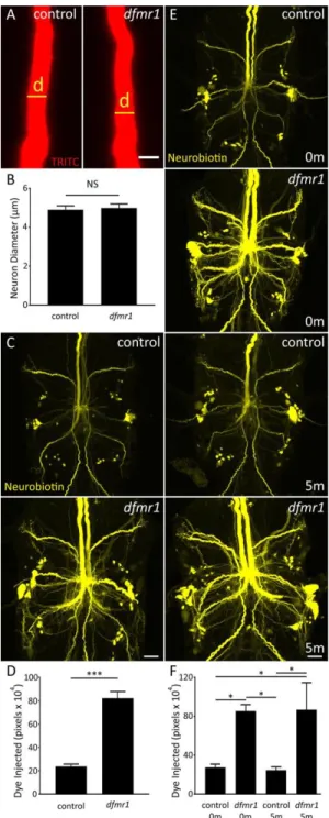 Figure 9. Dye Injection Defect is not Related to Multiple GFI Neuron Properties  