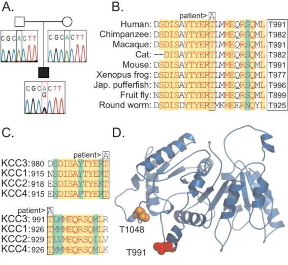 Figure 2-2. Identification of a de novo KCC3 T991A mutation in a patient with an early-onset, progressive,  and  severe  axonal  motor  neuron  neuropathy