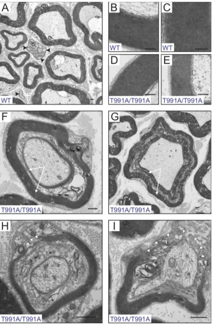 Figure  2-7. Electron micrographs of sciatic nerve fibers isolated from KCC3 wild-type and T991A mice