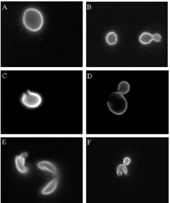 Figure 2.1: The panels illustrate the visual scoring algorithm designed to determine cell  disruption