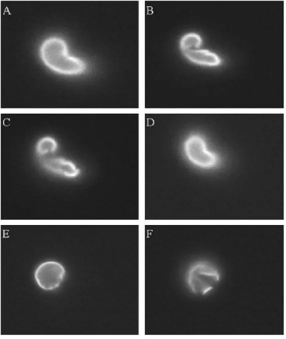 Figure  2.2:  This  panel  of  images  illustrates  the  importance  of  the  focal  plane  in  determining  cell disruption by the scoring algorithm