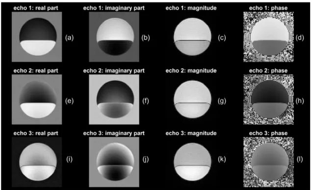 Figure 2.4 . Mineral oil Cartesian reconstruction: Panel (a) through (d) are real part imaginary  part, magnitude and phase information for the first echo, Panel (e) through (h) are for the  second echo; Panel (i) through (l) are for the third echo