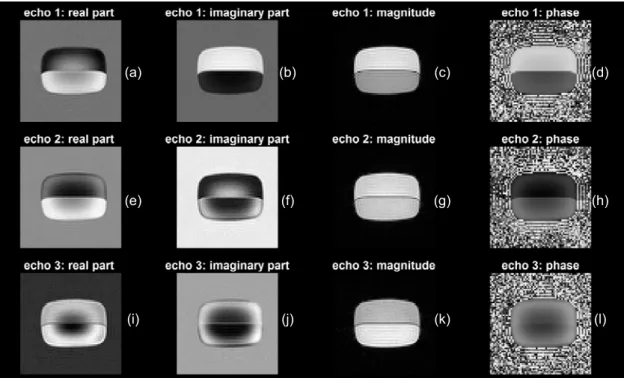 Figure 2.5 . The peanut oil phantom Cartesian reconstruction: Panel (a) through (d) are real  part imaginary part, magnitude and phase information for the first echo, Panel (e) through (h)  are for the second echo; Panel (i) through (l) are for the third e