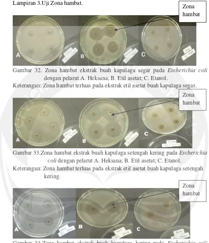 Gambar 32. Zona hambat ekstrak buah kapulaga segar pada Escherichia coli 