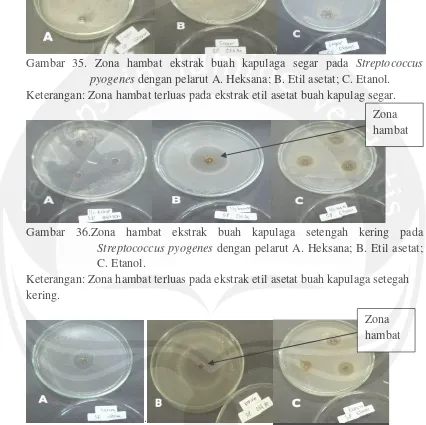 Gambar 35. Zona hambat ekstrak buah kapulaga segar pada Streptococcus 